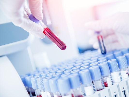 D-vitamiinimittaus kaupan päälle Synlabin laboratorioissa